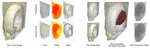 Monocular Depth Decomposition of Semi-Transparent Volume Renderings