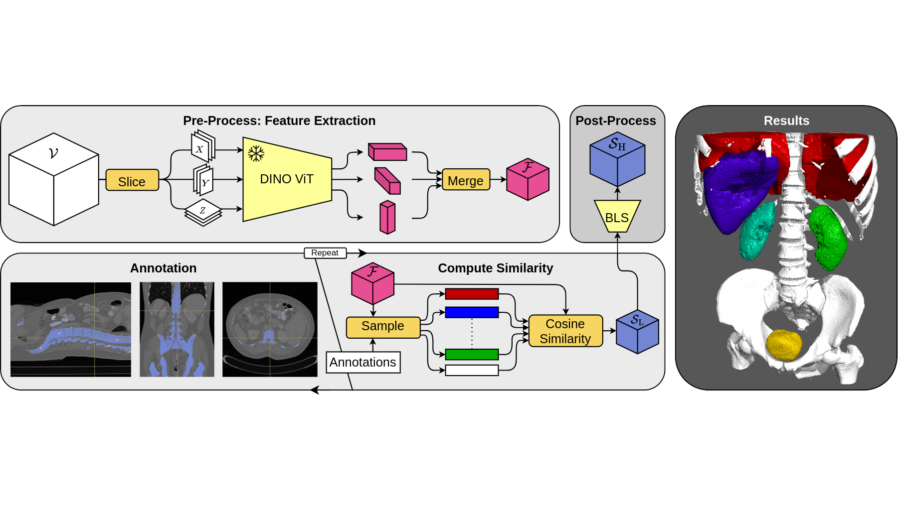 Leveraging Self-Supervised Vision Transformers for Segmentation-based Transfer Function Design