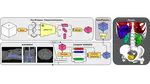 Leveraging Self-Supervised Vision Transformers for Segmentation-based Transfer Function Design